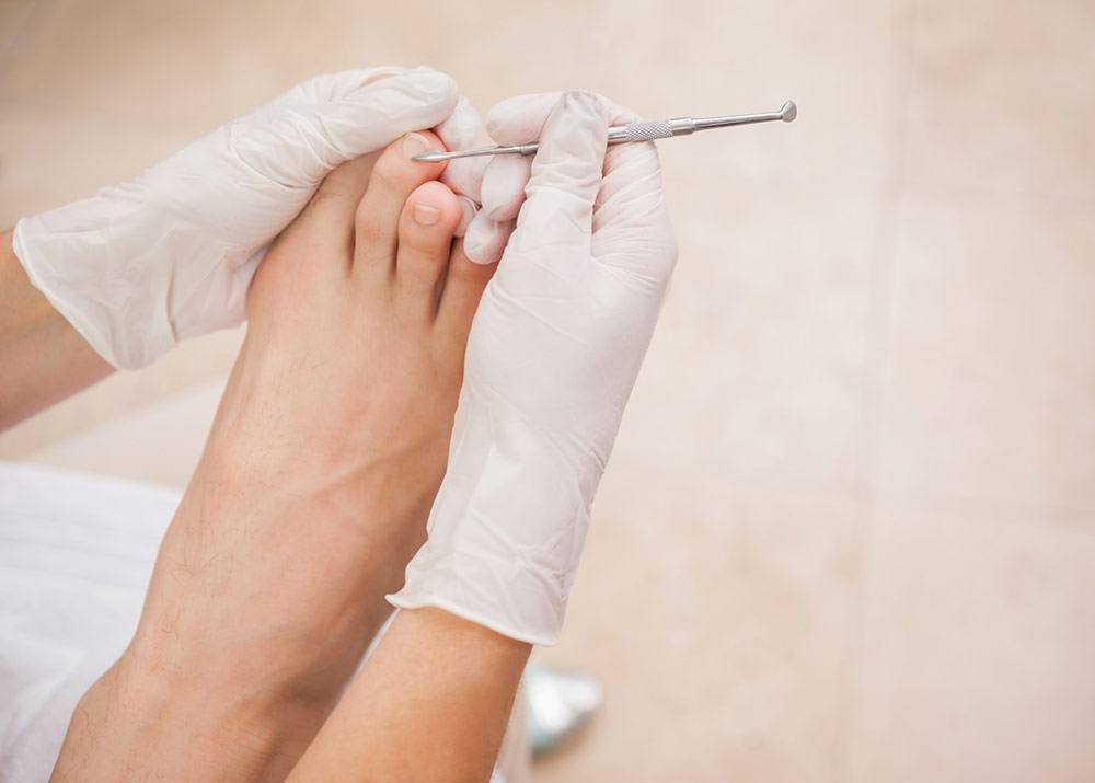 Professionelle Nagelpflege mit sterilem Instrument